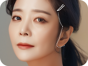 Face and Neck Lifting in LABOM Plastic Surgery in Seoul, Korea