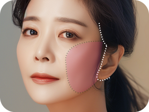 Face and Neck Lifting in LABOM Plastic Surgery in Seoul, Korea