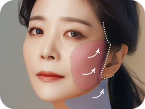 Face and Neck Lifting in LABOM Plastic Surgery in Seoul, Korea