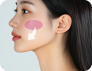 Face and Neck Lifting in LABOM Plastic Surgery in Seoul, Korea