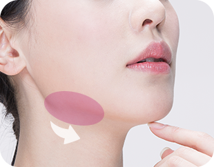 Face and Neck Lifting in LABOM Plastic Surgery in Seoul, Korea
