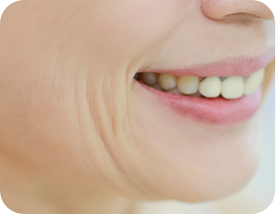 Face and Neck Lifting in LABOM Plastic Surgery in Seoul, Korea
