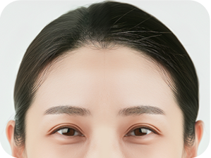 Brow Bone Reduction in Korea at LABOM Plastic Surgery in Seoul