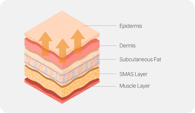 Face and Neck Lifting in LABOM Plastic Surgery in Seoul, Korea