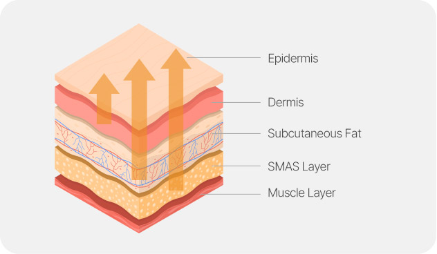 Face and Neck Lifting in LABOM Plastic Surgery in Seoul, Korea
