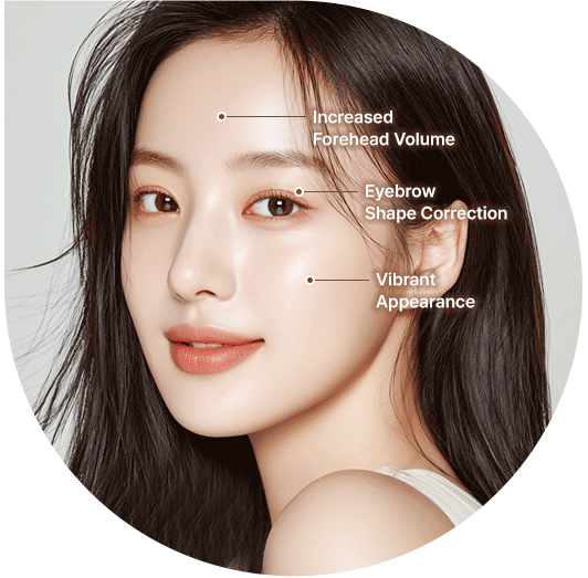 Endoscopic Brow Lift at LABOM Plastic Surgery in Seoul, Korea