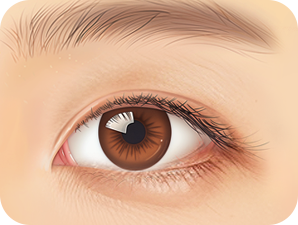 Upper Blepharoplasty in Korea at LABOM Plastic Surgery in Seoul