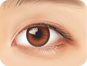 Lower Blepharoplasty in Korea at LABOM Plastic Surgery in Seoul