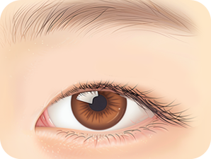 Double Eyelid Surgery in Korea at LABOM Plastic Surgery in Seoul