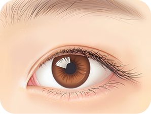 Double Eyelid Surgery in Korea at LABOM Plastic Surgery in Seoul