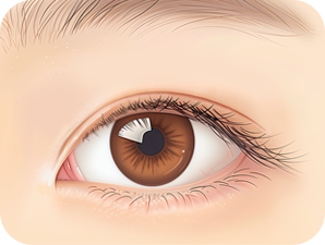 Ptosis Correction in Korea at LABOM Plastic Surgery in Seoul
