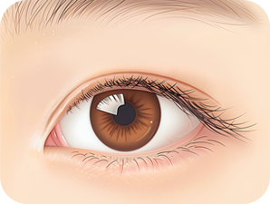 Canthoplasty in Korea at LABOM Plastic Surgery in Seoul
