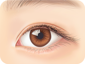 Canthoplasty in Korea at LABOM Plastic Surgery in Seoul