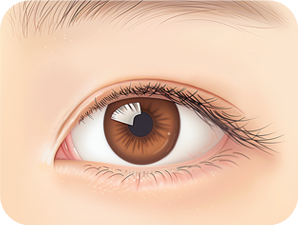 Canthoplasty in Korea at LABOM Plastic Surgery in Seoul