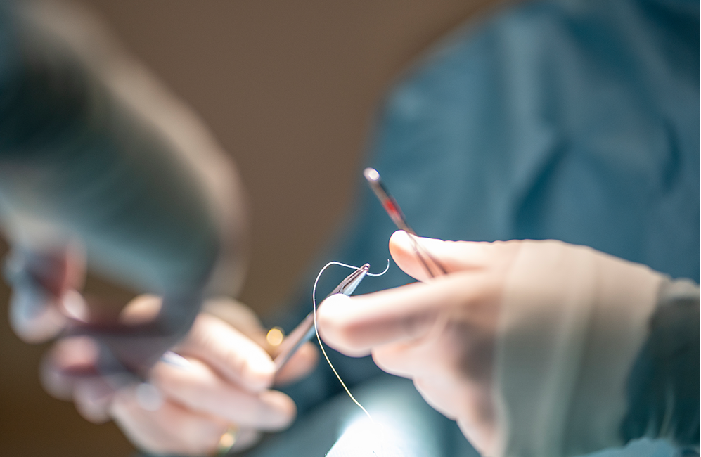 Canthoplasty Revision in Korea at LABOM Plastic Surgery in Seoul