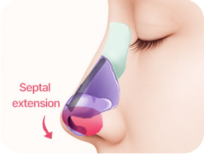 Rhinoplasty in Korea at LABOM Plastic Surgery in Seoul