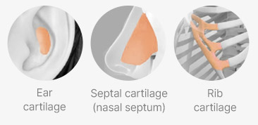 Non-surgical CarGel Rhinoplasty in Korea at LABOM Plastic Surgery in Seoul