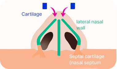 Rhinoplasty in Korea at LABOM Plastic Surgery in Seoul
