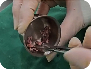 Non-surgical CarGel Rhinoplasty in Korea at LABOM Plastic Surgery in Seoul